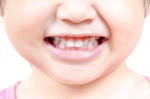 baby teeth